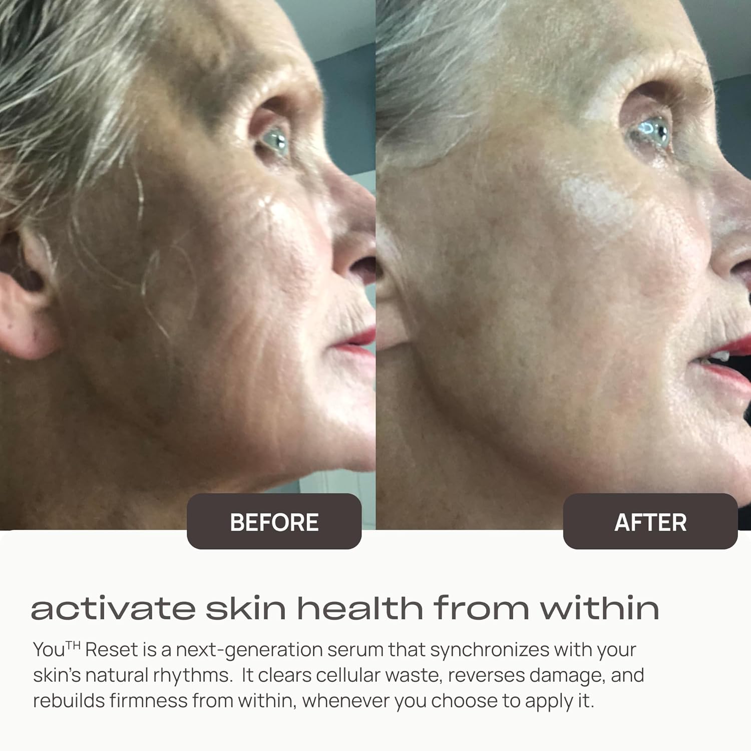 Young Goose, Youth Reset Serum | Cellular Regeneration and Repair | Improves Skin Texture | Promotes Skin Luminosity and Vibrancy - Large Size 30ml